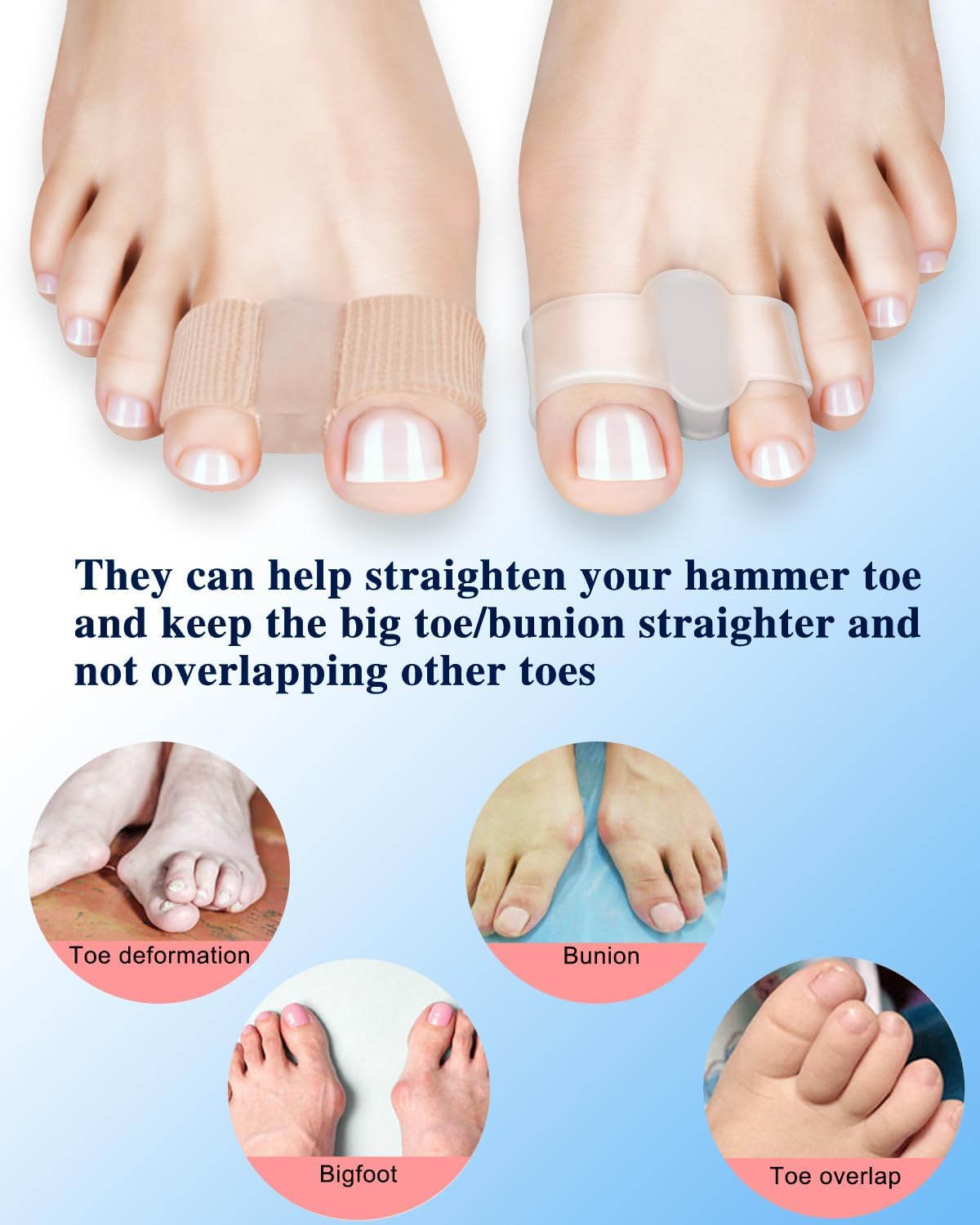 Toe Separators & Bunion Correctors - 4 or 8 Piece Set