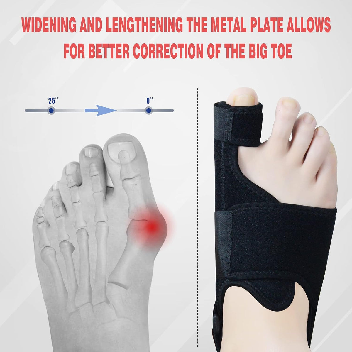 Night Bunion Splint & Toe Straightener for Alignment Support