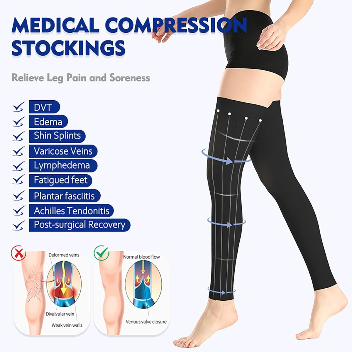 Thigh High Compression Stockings 20-30 mmHg | TheGivenGet