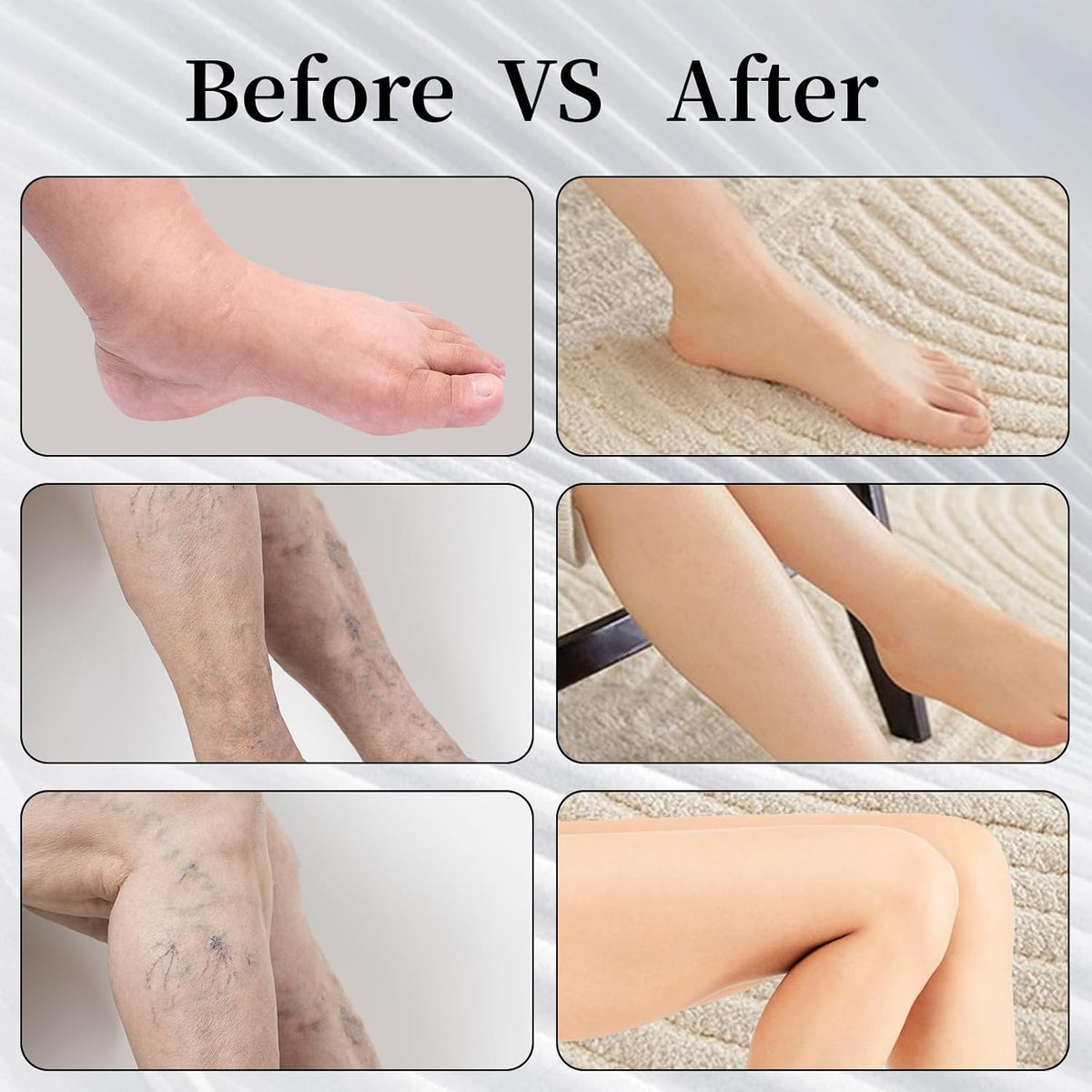 Thigh High Compression Stockings 20-30mmHg