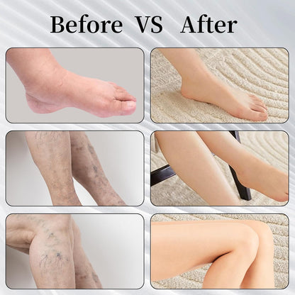Thigh High Compression Stockings 20-30mmHg