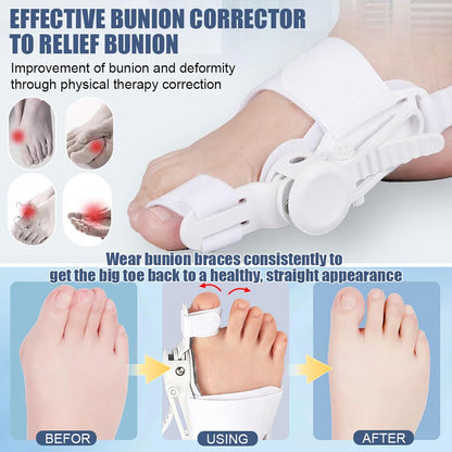 Nighttime Toe Alignment Splint with ABS Support | 2-Pack