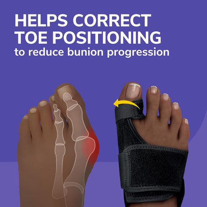 Bunion Corrector Splint & Toe Alignment System
