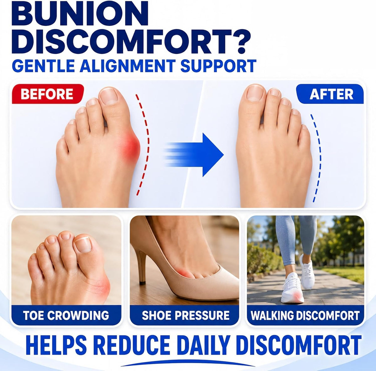 All-in-One Bunion Corrector Kit with Toe Separator & Gel Pad