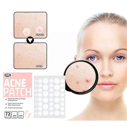 Invisible Acne Patches - Removal Pimple Anti-Acne Hydrocolloid Patches - Spots Marks Concealer Repair